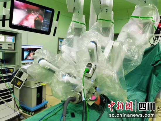 图为达芬奇手术机器人。成都市妇女儿童中心医院供图 图为达芬奇手术机器人。成都市妇女儿童中心医院供图