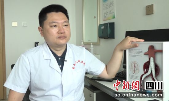 图为成都市第五人民医院普外(血管外科)团队副主任医师姚佐懿。陈选斌 摄 图为成都市第五人民医院普外(血管外科)团队副主任医师姚佐懿。陈选斌 摄