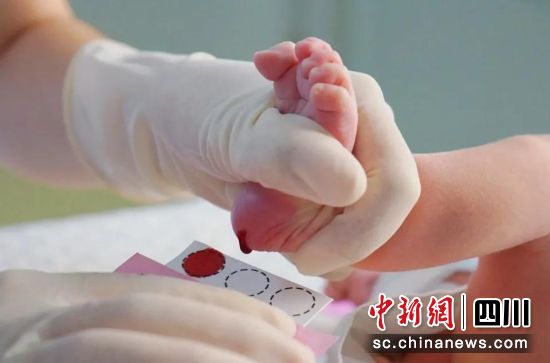 新生儿取足跟血接受筛查。成都市妇女儿童中心医院供图 新生儿取足跟血接受筛查。成都市妇女儿童中心医院供图
