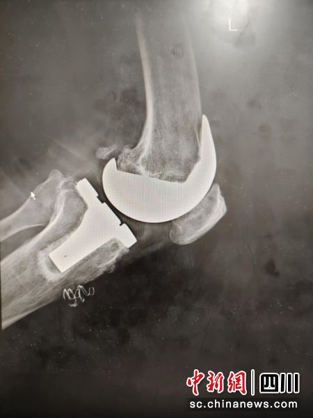 手术摄图。 王星 摄 手术摄图。 王星 摄