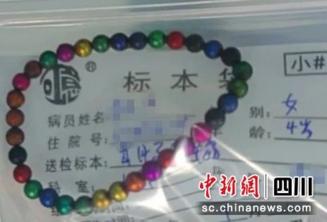 从小希肠道中取出的磁力珠。成都市妇女儿童中心医院 供图 从小希肠道中取出的磁力珠。成都市妇女儿童中心医院 供图