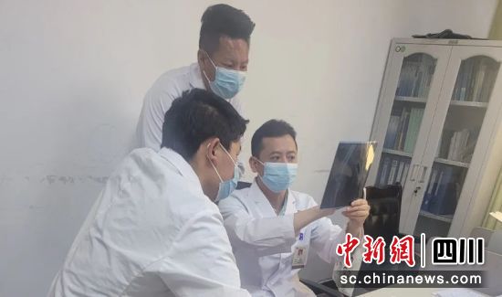 正在一起研究病情。成都市第三人民医院 供图 正在一起研究病情。成都市第三人民医院 供图