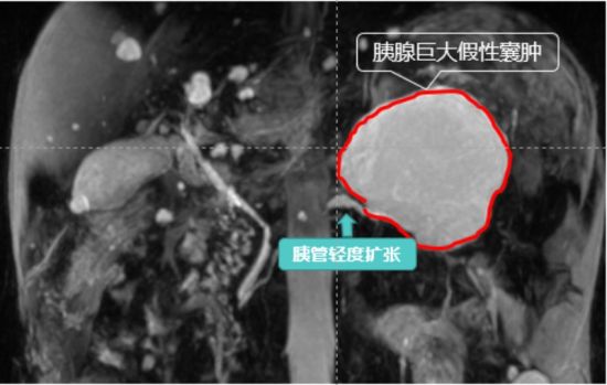 胰腺检查图像显示。单晶 摄 胰腺检查图像显示。单晶 摄