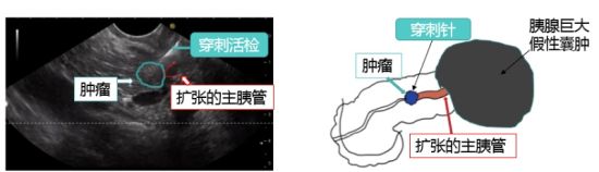 胰腺图对比分析。单晶 摄 胰腺图对比分析。单晶 摄